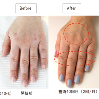 手の病院サロン特別体験会